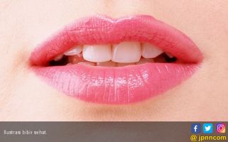 3 Tips Mendinginkan Bibir Terbakar Akibat Sinar Matahari - JPNN.com