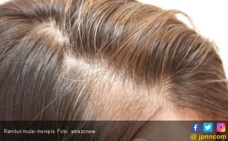 Rambut Menipis, Kenali 5 Kesalahan dalam Merawatnya - JPNN.com