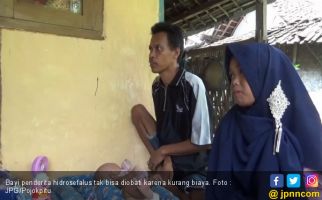 Tolong Bantu Biaya Pengobatan Bayi Hidrosefalus Ini.. - JPNN.com