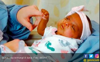Bayi Prematur Terkecil di Dunia, Bobot Hanya Seberat Apel - JPNN.com