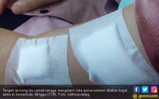 Begal Sadis Beraksi, Tangan Ibu Pengendara Motor Ditebas hingga Begini - JPNN.com