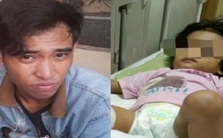 Bocah Dua Tahun Patah Tulang Dianiaya Pacar Ibunya - JPNN.com