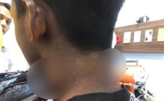 Leher Muhammad Idul Terluka Parah Diserang Ikan Sori, Kondisinya Kayak Begini - JPNN.com
