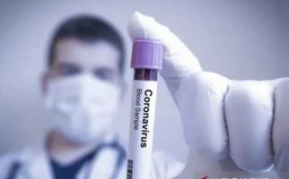 Uganda Diteror Virus Corona, Turki Sumbangkan 100 Sepeda, Apa Manfaatnya Ya? - JPNN.com