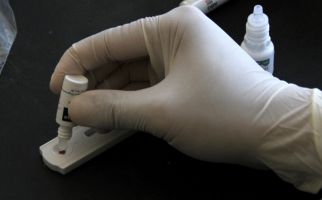 Operasi Lilin Plus 2020 Sediakan 30 Pos Pelayanan Rapid Test Antigen Gratis - JPNN.com