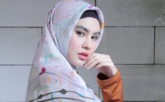 Dituduh Kena Azab, Kartika Putri Ungkap Kondisi Wajahnya - JPNN.com