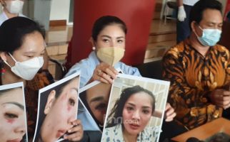 Jadi Korban KDRT, Nindy Ayunda Tunjukkan Foto Lebam di Wajah Hingga Rambut Rontok - JPNN.com