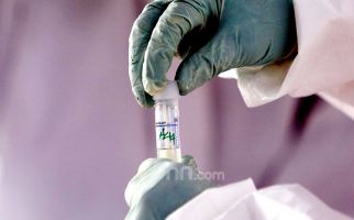 Uji Coba Vaksin Corona kepada 10.260 Orang, Semoga Ada Kabar Baik - JPNN.com