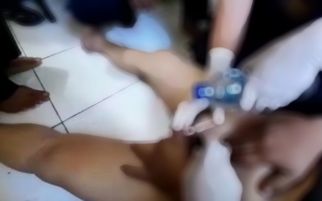 Kata Pemadam Seusai Evakuasi Ring yang Menjepit Anu Pria di Tangerang, Agak Geli Gimana Gitu - JPNN.com