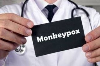 Cara Mencegah Terinfeksi Penyakit Cacar Monyet, Mudah Kok - JPNN.com Jateng