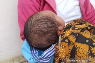 Rutin Cek Popok Bayi untuk Mengantisipasi Gagal Ginjal Akut - JPNN.com Sumbar