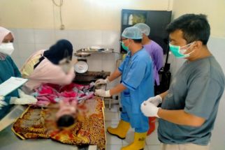 Sadis, Hasil Autopsi Ungkap Bayi Dalam Plastik Disekap Sebelum Dibuang di Pinggir Jalan - JPNN.com Bali
