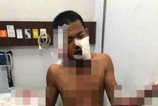 Warga Muaro Jambi Ditebas Parang 2 Pria Misterius, Darah Berceceran, Ngeri - JPNN.com Bali