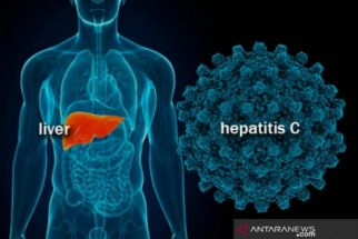 Ahli Sebut Penderita Hepatitis Boleh Jalani Vaksinasi Covid-19 - JPNN.com Jatim
