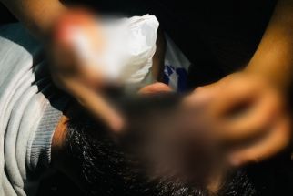 Lagi Nongkrong, Pengunjung Warkop di Jalan Dinoyo Surabaya Dikeroyok, 2 Orang Terluka - JPNN.com Jatim