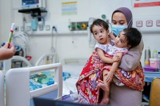 Lihat, RSHS Bandung Pisahkan Bayi Kembar Siam Zaina dan Zahira - JPNN.com Jabar