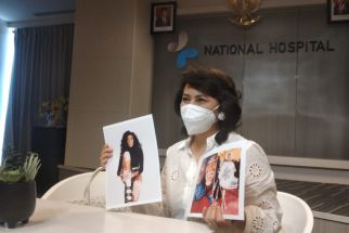 Cara Mengobati Penyakit Kulit Vitiligo menurut Dokter Ni Putu Ary Widhyasti - JPNN.com Jatim