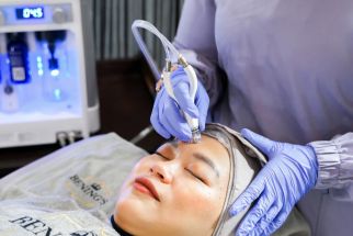 Tampil Cantik saat Pergantian Tahun, Bening’s Clinic Punya Treatment Khusus - JPNN.com Jabar