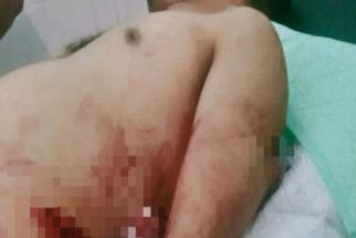 Staf Ini Bacok Sekretaris Diskoperindag Tanggamus, Begini Penjelasan Saksi Mata - JPNN.com Lampung