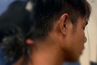 Mengerikan, Busur Tertancap di Belakang Leher saat Melintas di Kendari Beach - JPNN.com Sultra