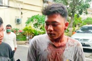 Canda Berujung Petaka, Mahasiswa Ini Berlumuran Darah Datangi Kantor Polisi - JPNN.com Sumut