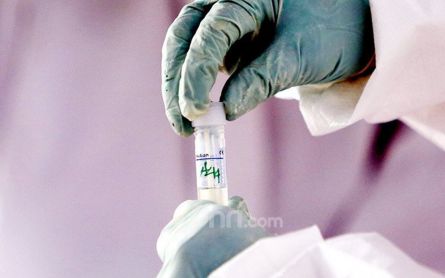 Economist Alleges PCR Test Mafia That Provides False Results - JPNN.com English