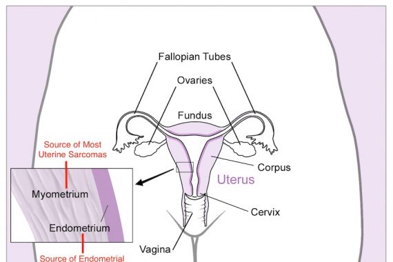 Peneliti: Melahirkan Bisa Turunkan Risiko Terkena Kanker Endometrium - JPNN.COM
