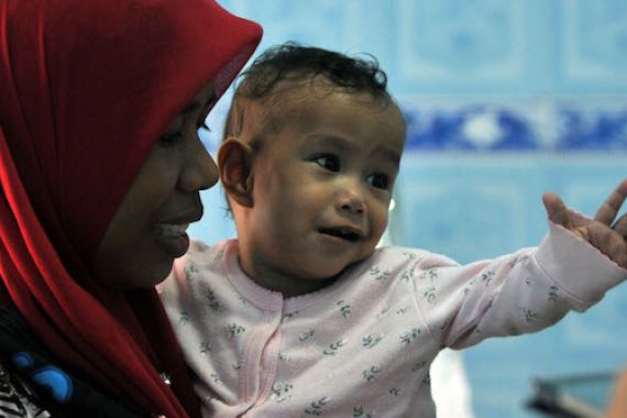 Operasi Jantung Rahmi Masih Tunggu Diagnosis Ulang - JPNN.COM
