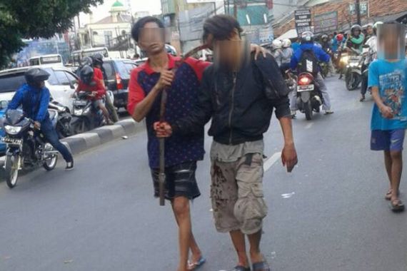 Polisi Cek Foto Remaja dengan Kepala Tertancap Celurit, Ngeri - JPNN.COM
