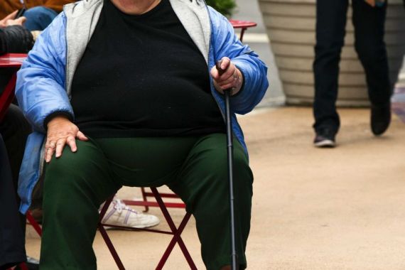 Benarkah Obesitas Menambah Risiko Terjangkiti Virus Corona? - JPNN.COM
