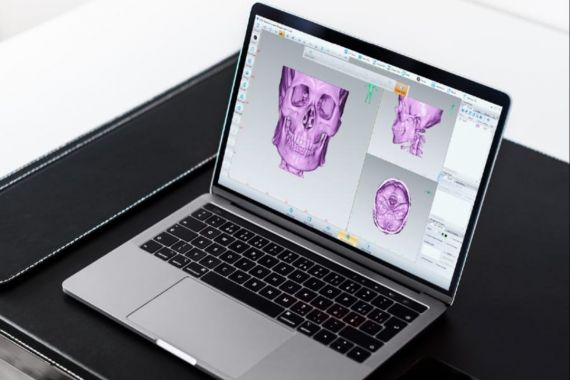 RS Mandaya Terapkan Teknologi 3D dalam Proses Medis - JPNN.COM