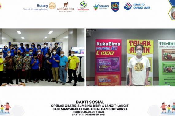 Gandeng Rotary Club, Sido Muncul Gelar Operasi Bibir Sumbing Gratis untuk Anak-Anak di Tegal - JPNN.COM