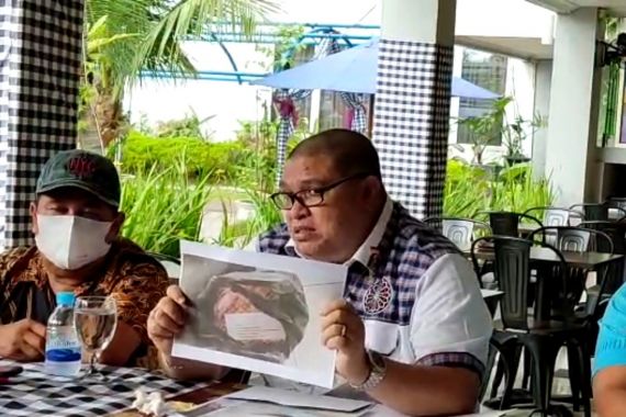 Razman Arif Nasution Mendapat Kiriman Paket Kepala Kambing Busuk, Gempar! - JPNN.COM