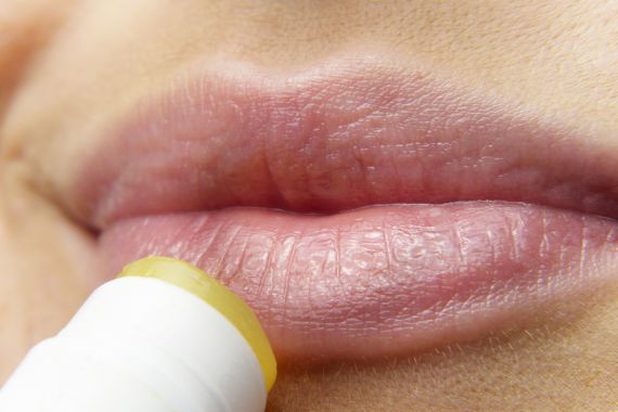 Bibir Terlihat Gelap, Atasi dengan 6 Cara Ampuh Ini - JPNN.COM