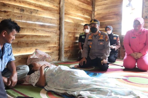 6 Bulan Riana Lumpuh, Irjen Iqbal Bertindak Cepat, Sihotang: Masih Banyak Polisi Baik - JPNN.COM