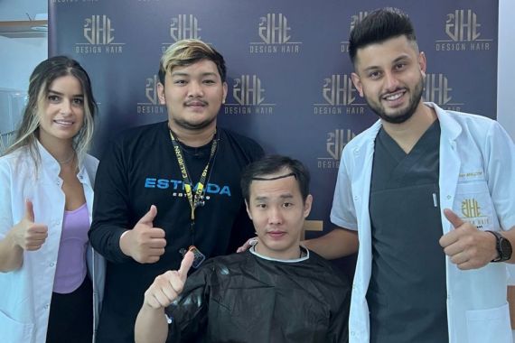 Punya Masalah Kebotakan Rambut, Coba Tips Ini, Mudah Banget - JPNN.COM