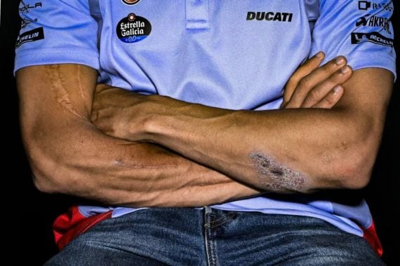 Jadwal MotoGP Catalunya 2024, Luka Marc Marquez jadi Sorotan - JPNN.COM