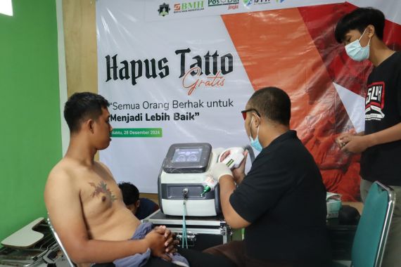 Bantu Kuatkan Hijrah Masyarakat, BMH Yogyakarta Gelar Layanan Hapus Tato - JPNN.COM