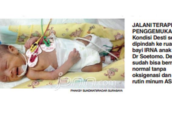 Bayi Kembar Siam, Desti Sehat Walafiat - JPNN.COM