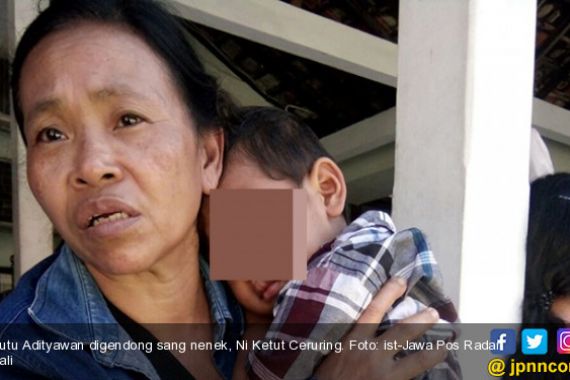 Nanah dan Darah Tak Henti Mengalir, Bocah 2,5 Tahun di Bali Idap Tumor Mata - JPNN.COM