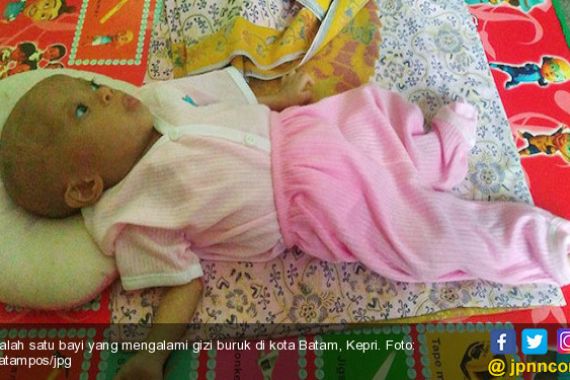 Dua Bayi di Kota Batam Ini Alami Gizi Buruk, Memprihatinkan Sekali... - JPNN.COM