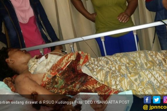 Hendak Salat Subuh Disambar Buaya, Tangan Nyaris Putus - JPNN.COM