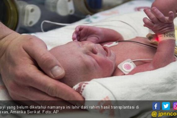 Luar Biasa, Bayi Lucu Ini Lahir dari Rahim Transplantasi - JPNN.COM