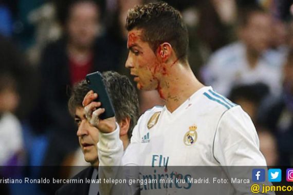 Real Madrid Pesta Gol, Cristiano Ronaldo Berdarah - JPNN.COM
