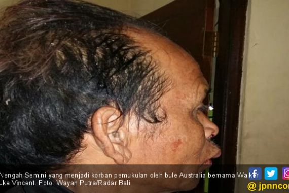 Hajar Warga Bali, Bule Australia Ditangkap Polisi - JPNN.COM