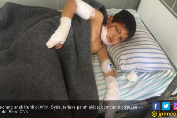 Penderitaan Anak-Anak Kurdi Dibombardir Pasukan Erdogan - JPNN.COM