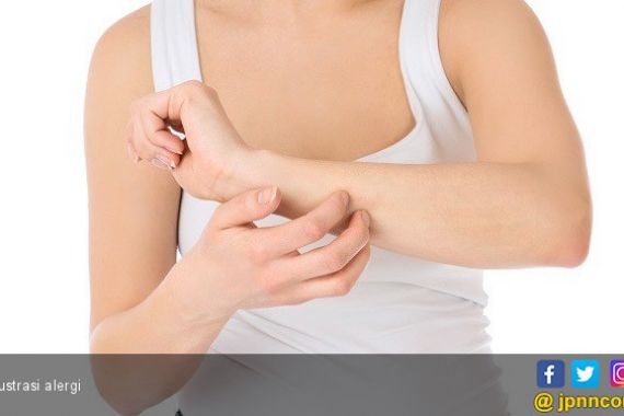 4 Cara Mengatasi Alergi - JPNN.COM