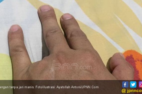 Dikeroyok Pakai Celurit, ABG 13 Tahun Kehilangan Jari Manis - JPNN.COM