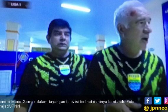 Curhat Pelatih Persib usai Terluka dalam Laga Versus Arema - JPNN.COM
