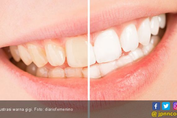 6 Tips Memutihkan Gigi yang Terlihat Kuning, Anti Ribet Lho - JPNN.COM